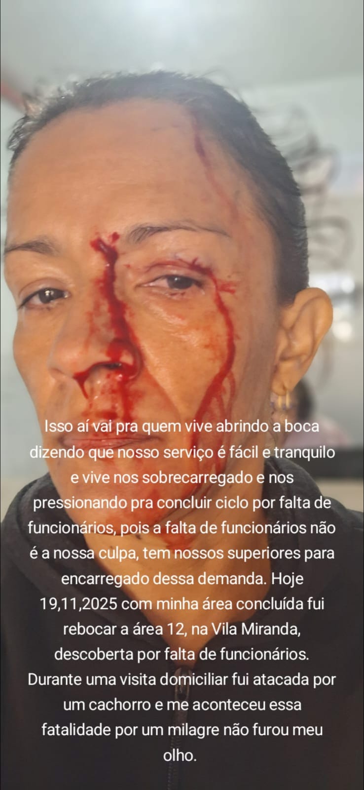 ARAGUATINS: Os Heróis Invisíveis das Ruas ACE e ACS Expostos a Riscos Diários em Nome da Saúde Comunitária